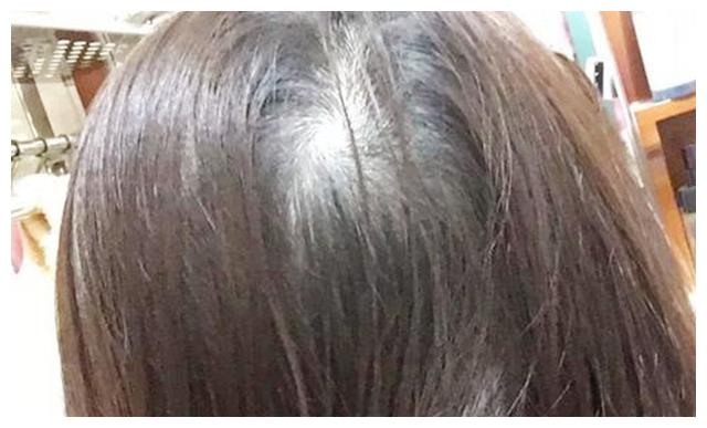 "一旋横二旋楞三旋吵架没毛病",孩子头顶的旋,究竟有什么说法