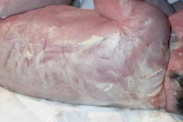 胎脂 对胎儿 有 什么 作用?