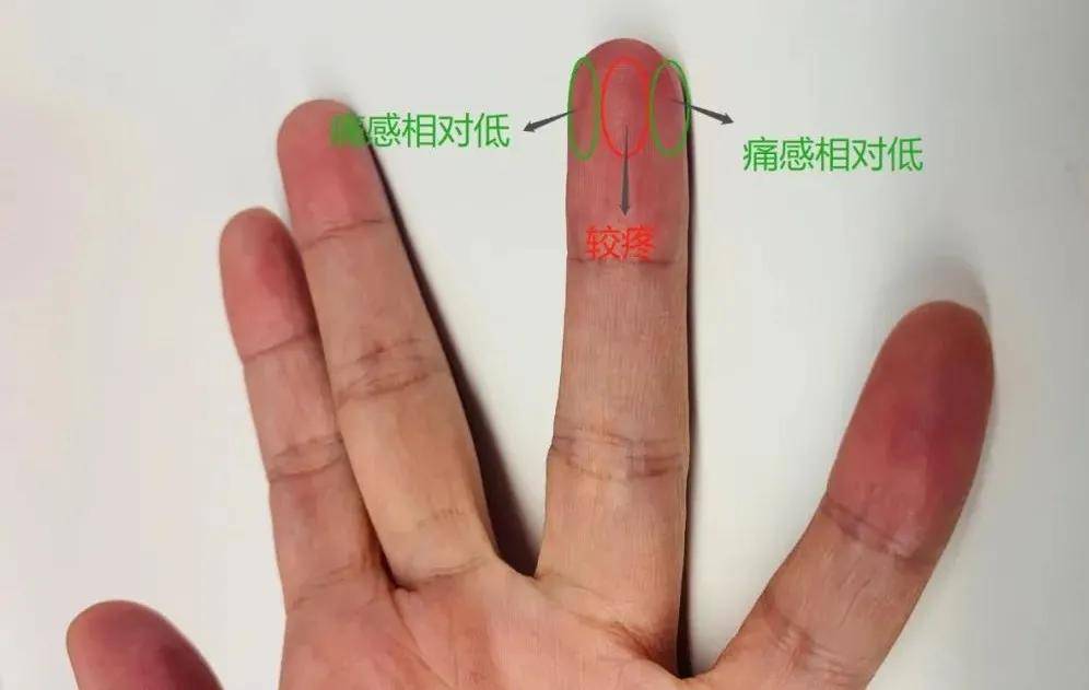 采血的注意事项