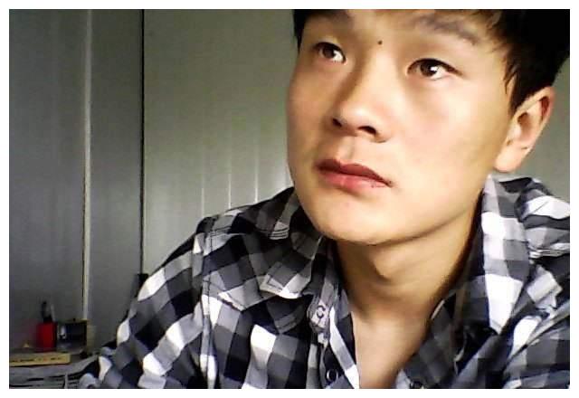 男人天庭长痣看命运,预示事业有成,前途无量的吉痣|天庭|长辈|部位