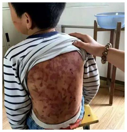 "13岁男孩被后爸毒打1小时,母亲含泪报警