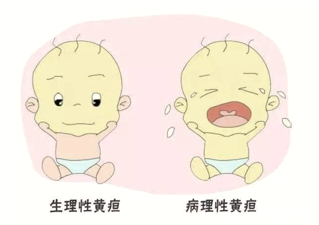 大惊小怪 新生儿第一周的七大特殊生理现象