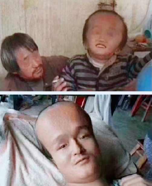 12年过去,那些喝三鹿奶粉长大的孩子,如今怎样了?看完泪目