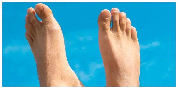 从脚相看富贵命,这样的人最有钱|脚趾|脚趾甲|富贵_新浪新闻