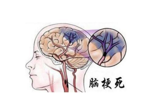 男性过了65岁后,若还能坚持做好这4件事,或说明体质还不错休闲区蓝鸢梦想 - Www.slyday.coM 男性过了65岁后,若还能坚持做好这4件事,或说明体质还不错休闲区蓝鸢梦想 - Www.slyday.coM