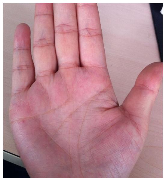 有这种手纹的人,婚后易红杏出墙,且有两次婚姻