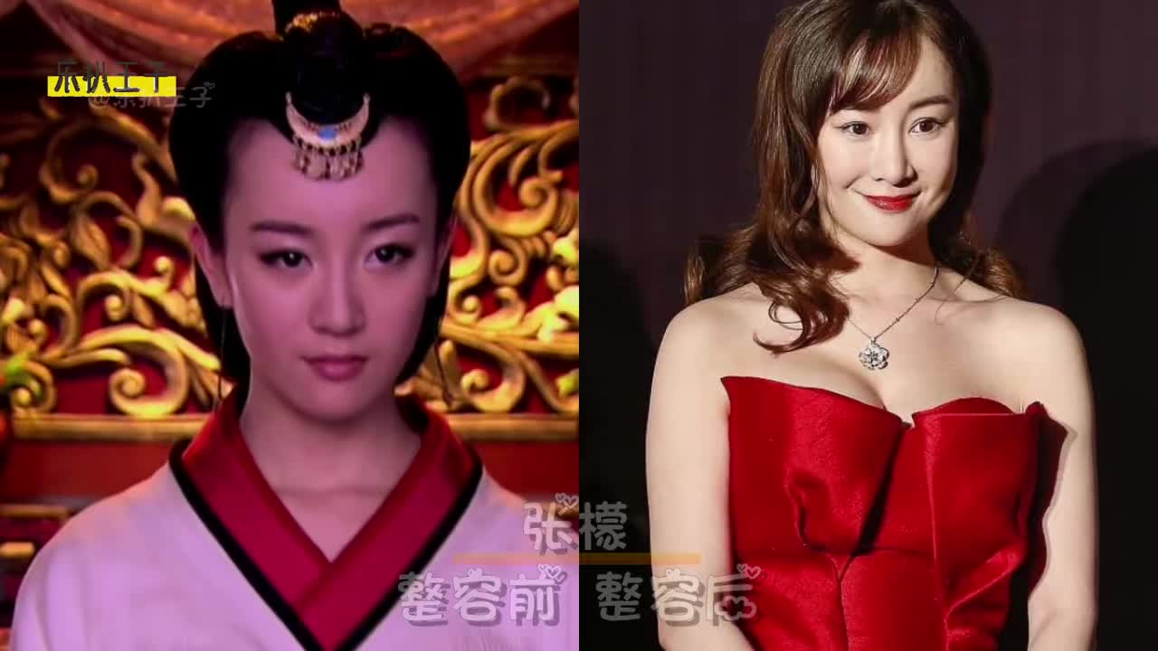 张檬:我整容后不红了,金晨:我整容后嘴歪了,鞠婧祎:没点出息
