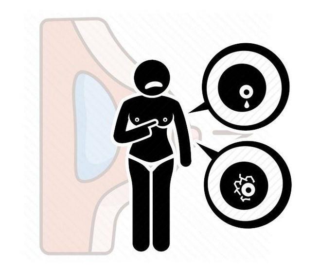 女子患癌被蛊惑耽误治疗而亡?关于乳腺癌,5个误区坑了多少人休闲区蓝鸢梦想 - Www.slyday.coM 女子患癌被蛊惑耽误治疗而亡?关于乳腺癌,5个误区坑了多少人休闲区蓝鸢梦想 - Www.slyday.coM