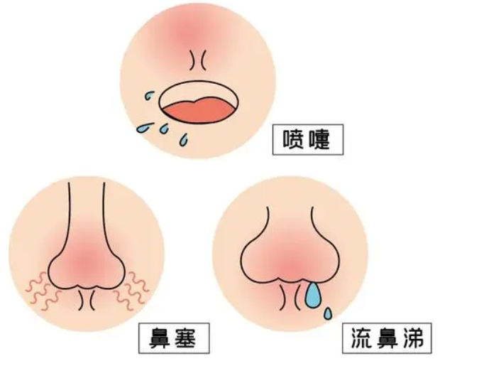 过敏性鼻炎不仅要定期清理鼻腔要做到4个坚持要做