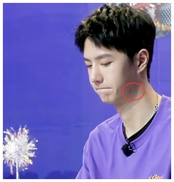 《天天向上》王一博点评险些揪秃仙女笔,表情可爱脖子红印成亮点