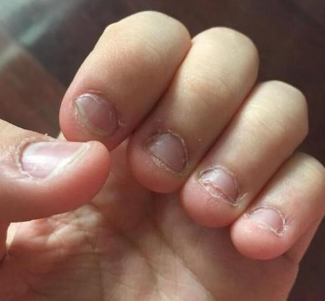 "方法,并用温和的语气和鼓励性的言语告诉孩子咬手指是不良好的行为