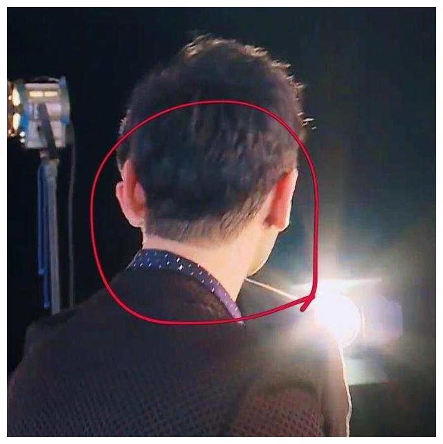 乘风破浪的姐姐黄晓明戴假发套男明星也逃不过中年秃头危机