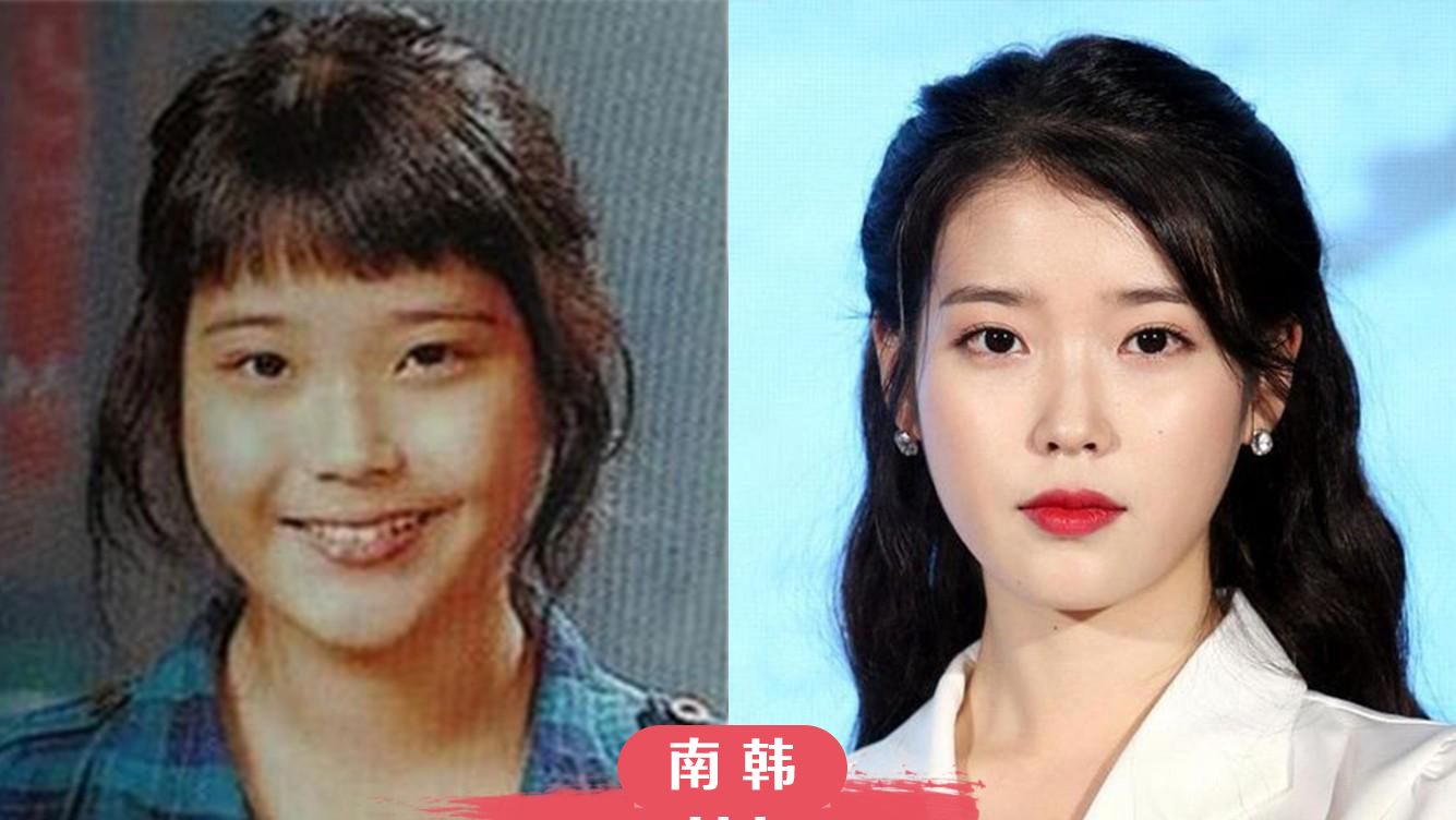 南韩变脸合集1：朴敏英双眼皮宛如妈生、IU是小胖妞，她改变最大|朴敏英|双眼皮|金贤重