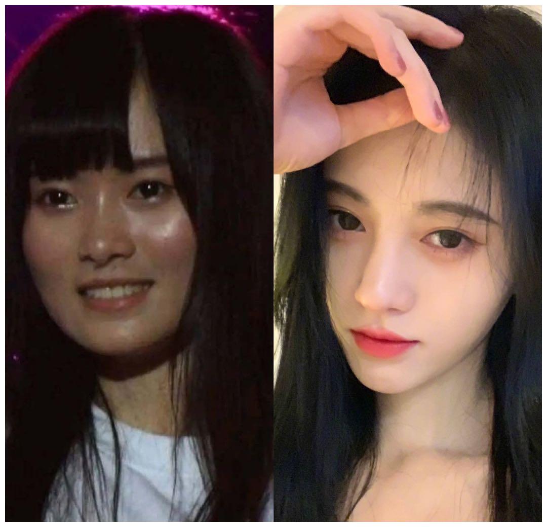 范丞丞周深和童年照一模一样贾玲曾很美鞠婧祎再添整容疑云