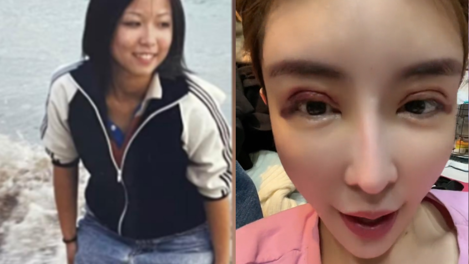 花费百万整形11次!女网红整容前后对比,网友:这是同一个人?|网红整容_新浪新闻