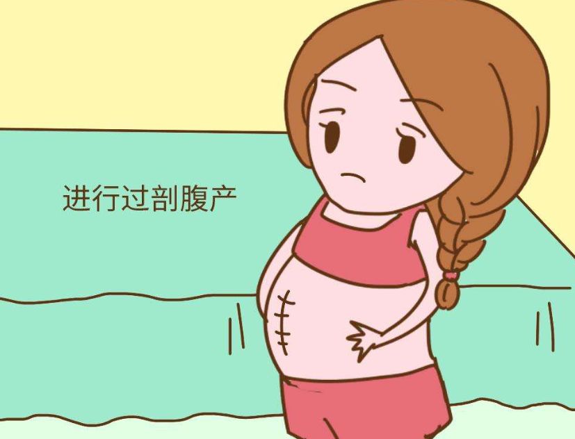 孕产需知剖宫产的影响