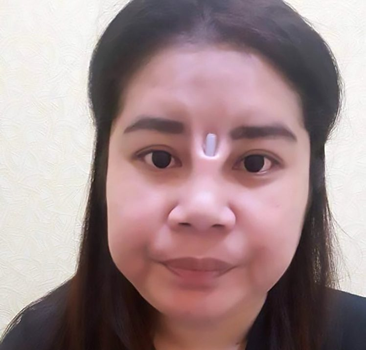 女子贪图便宜做廉价整容,结果险被丈夫赶出家门!原因太丑了