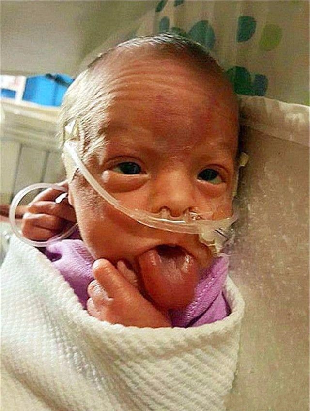 刚出生女婴患罕见怪病,人未长大器官就疯长,但更奇怪的事在后面