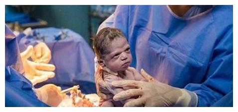 巴西"臭脸"宝宝火了,生无可恋凝视医生,网友:她被孟婆给骗了