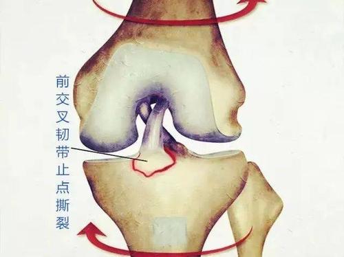 韧带|关节|膝关节_新浪新闻