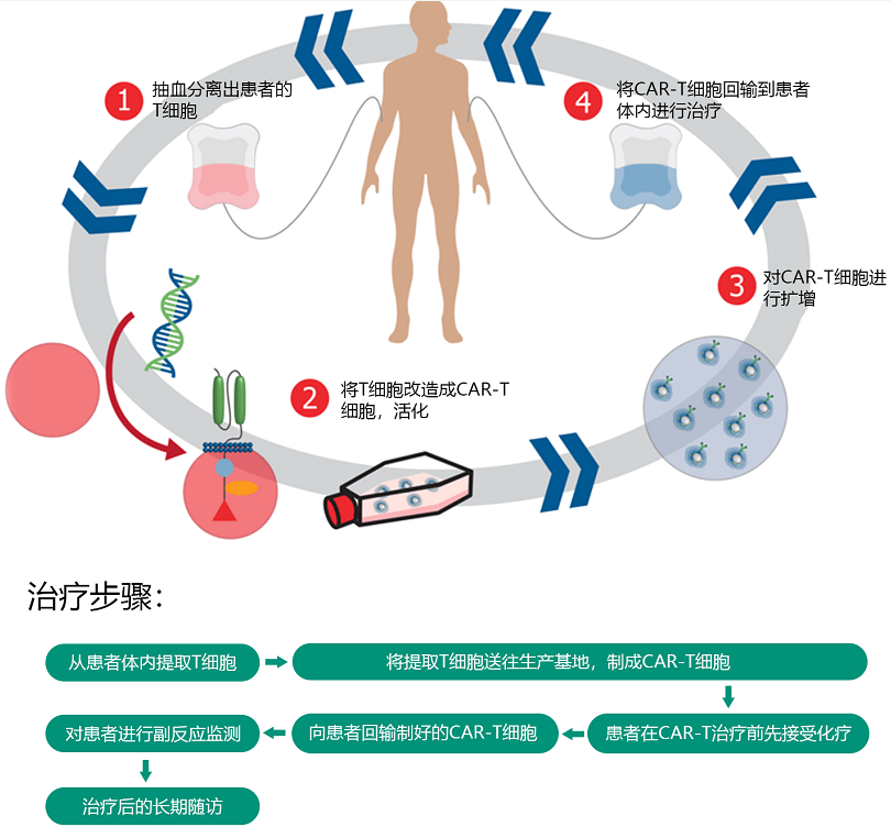 car-t细胞免疫疗法 图源:梅斯医学据张红宇主任介绍,car-t细胞免疫
