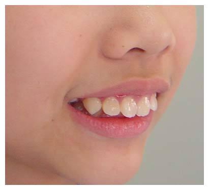 以后很难避开"变丑"结局,希望你家没有|你家|大姐|嘴巴_新浪新闻