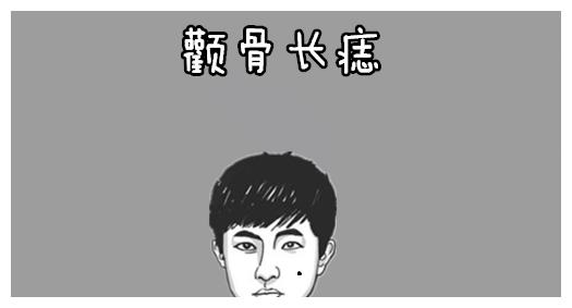 颧骨长痣颧骨长的好坏对一个人的权利,仕途的影响会非常的大,若是此处
