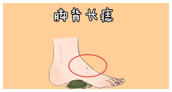 脚背长痣女人的脚背处长有吉痣,则天生主贵,就是一个富态相,往往长在