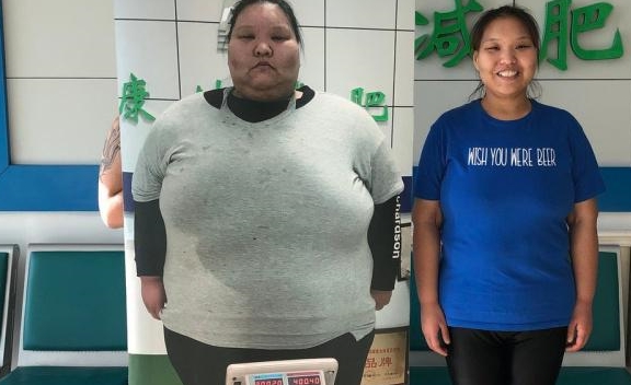 400斤河北女孩11月减214斤为何新一年只愿减30斤