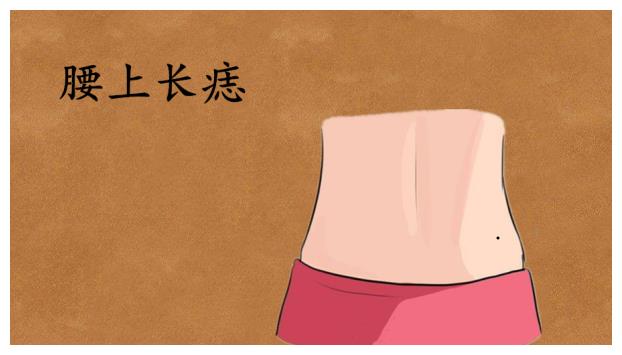 身体5颗吉痣,男人得财,女人旺夫,子孙辈辈发大财