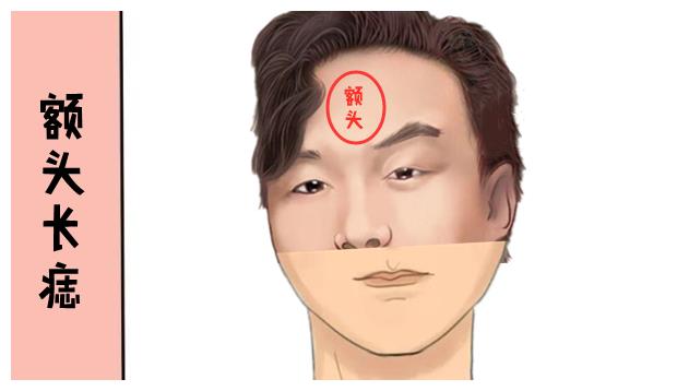 进财痣,男人5大吉痣,钱财赶着来,个个富甲一方,财大气粗