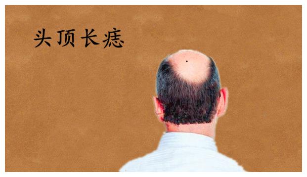 身体5颗吉痣,男人得财,女人旺夫,子孙辈辈发大财