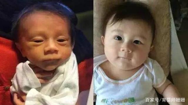 宝宝刚出生时有多丑?满月就能看到大变化,宝妈:幸亏当初没扔了休闲区蓝鸢梦想 - Www.slyday.coM 宝宝刚出生时有多丑?满月就能看到大变化,宝妈:幸亏当初没扔了休闲区蓝鸢梦想 - Www.slyday.coM