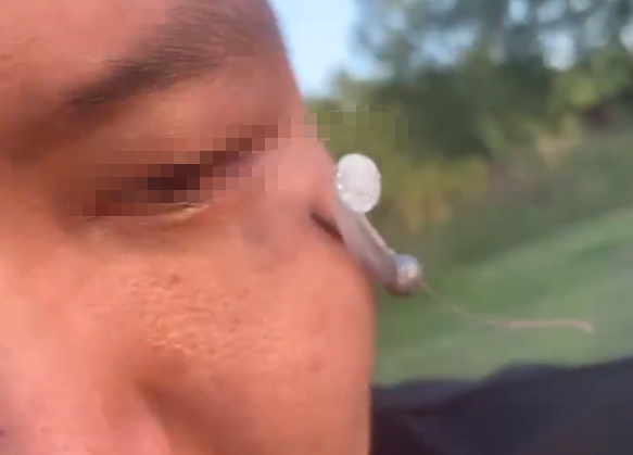 看着都疼,玩路亚虽快乐,做好防护太重要,钓到自己很痛苦休闲区蓝鸢梦想 - Www.slyday.coM 看着都疼,玩路亚虽快乐,做好防护太重要,钓到自己很痛苦休闲区蓝鸢梦想 - Www.slyday.coM