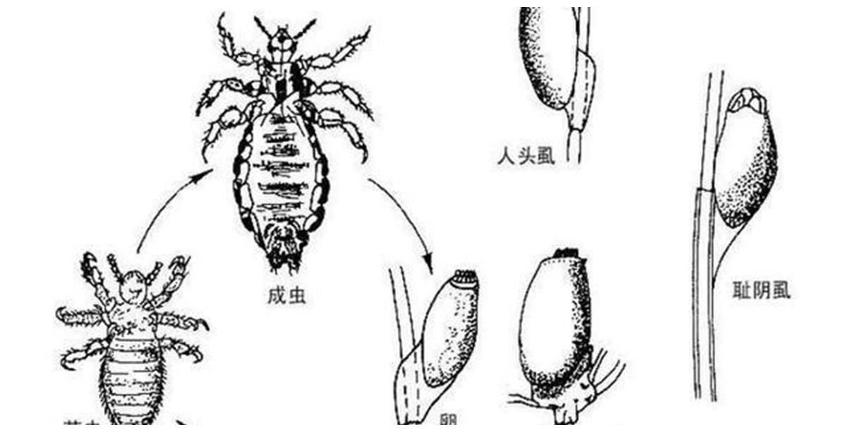 头虱主要是寄生在人的头发上,衣虱主要是寄生在人的身体之上,阴虱只