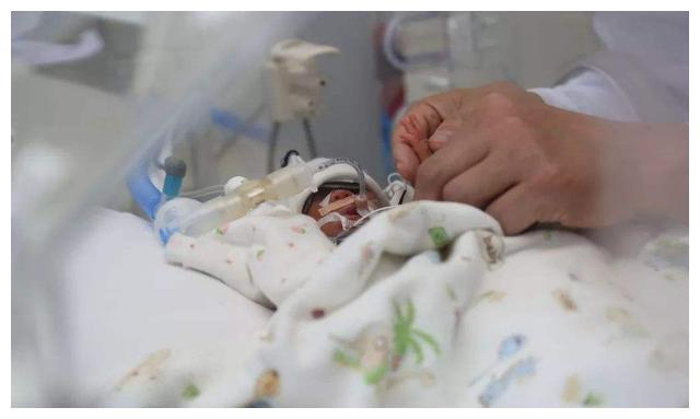 世界最小的婴儿刚出生只有巴掌大小后来却成了这样