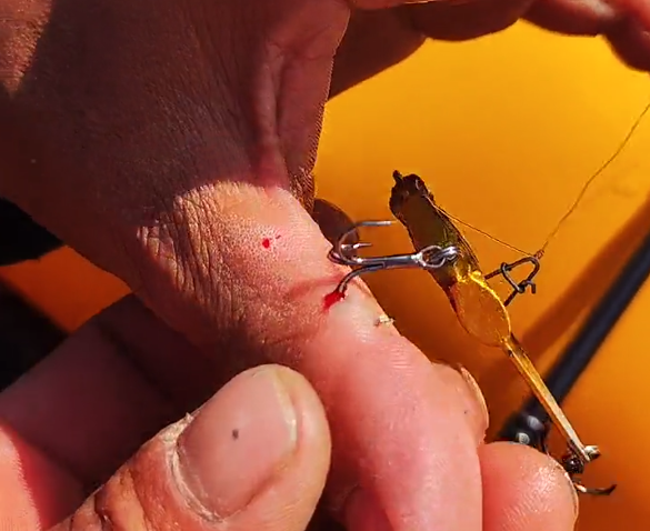 看着都疼,玩路亚虽快乐,做好防护太重要,钓到自己很痛苦休闲区蓝鸢梦想 - Www.slyday.coM 看着都疼,玩路亚虽快乐,做好防护太重要,钓到自己很痛苦休闲区蓝鸢梦想 - Www.slyday.coM