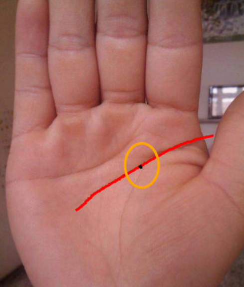 女人智慧线上有痣如果一个女人的手掌智慧线上长痣,而且是出生就有的