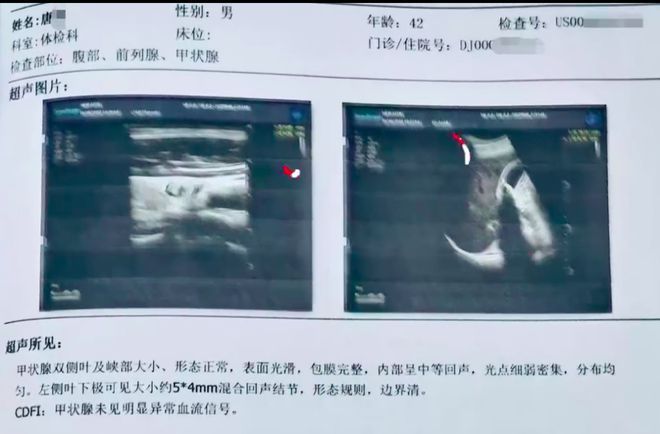 42岁男子体检查出有子宫？“老婆都怀疑有问题”！医院回应休闲区蓝鸢梦想 - Www.slyday.coM