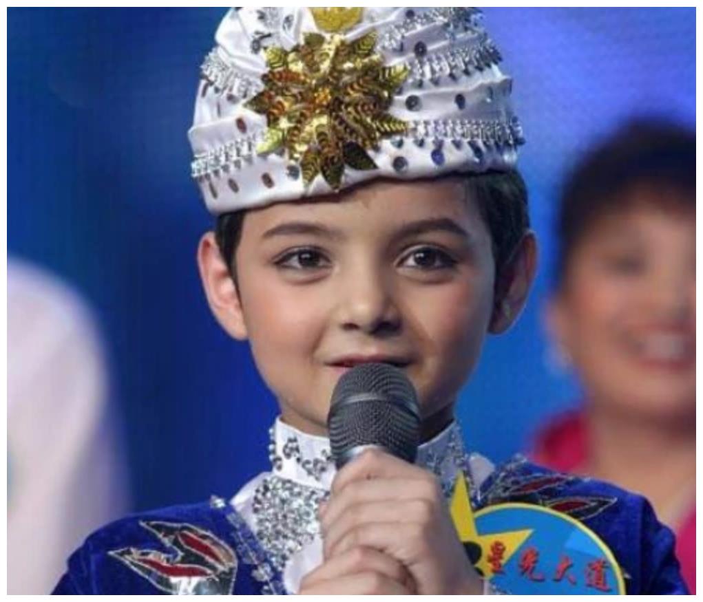 童星阿尔法变脸式长大曾因秃顶众人嘲如今帅成混血超模脸