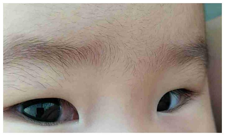 1,调理饮食发现孩子脾虚积食了,家长们应该及时调理孩子脾胃,不然会