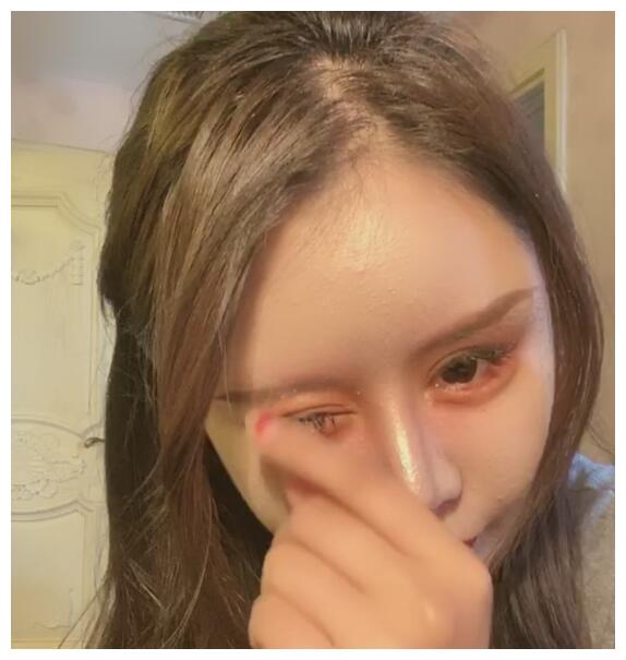 网红小z娜娜向网友展示整容400次的最新成果:整张脸非常夸张__财经