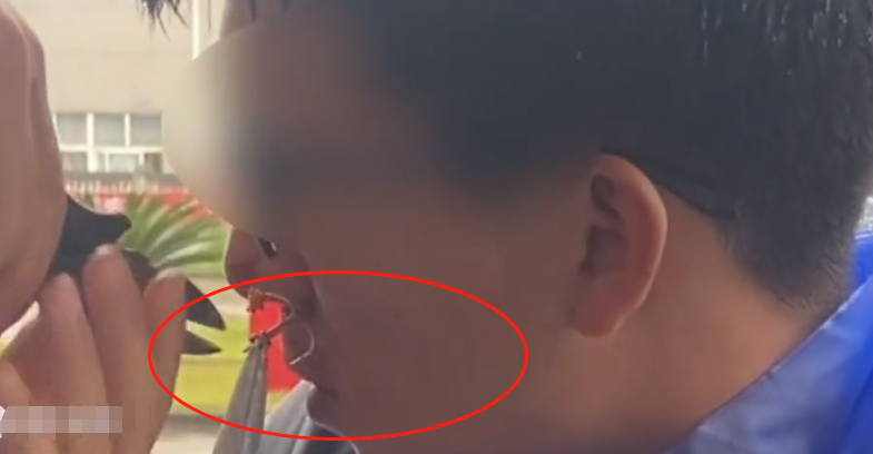 看着都疼,玩路亚虽快乐,做好防护太重要,钓到自己很痛苦休闲区蓝鸢梦想 - Www.slyday.coM 看着都疼,玩路亚虽快乐,做好防护太重要,钓到自己很痛苦休闲区蓝鸢梦想 - Www.slyday.coM