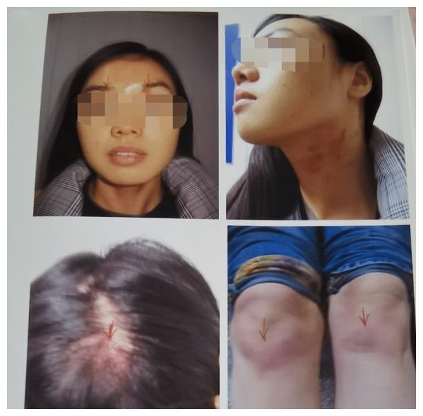 男方家暴嗜赌,女方5年4次起诉离婚,不料被法院一一驳回休闲区蓝鸢梦想 - Www.slyday.coM 男方家暴嗜赌,女方5年4次起诉离婚,不料被法院一一驳回休闲区蓝鸢梦想 - Www.slyday.coM