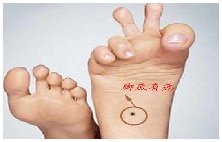 这7个地方是福痣拥有者能带来好运可千万别点