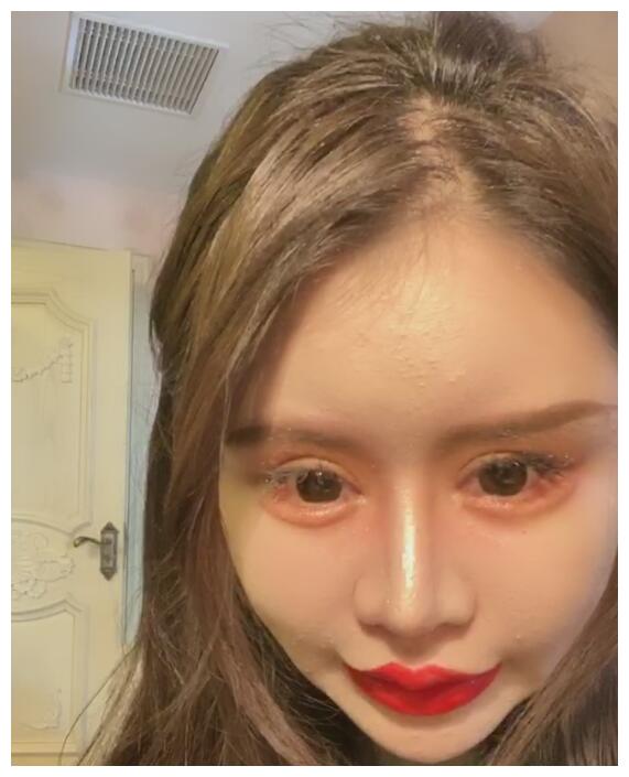 网红小z娜娜向网友展示整容400次的最新成果整张脸非常夸张