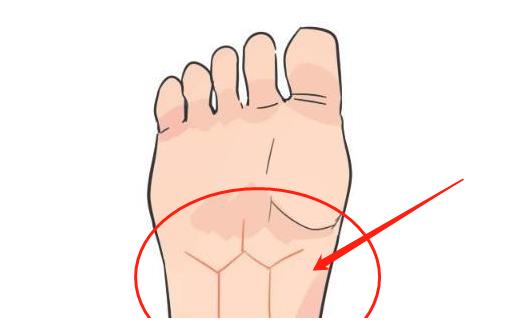 龟纹顾名思义就是脚底长得一个像乌龟的纹路,有此纹路的人生来就是做