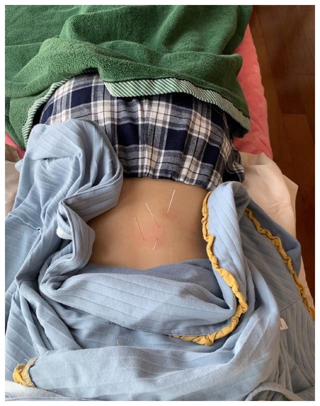 钟楚曦受伤也不忘悼念张国荣,还自曝腰韧带受伤,直呼动弹不得?