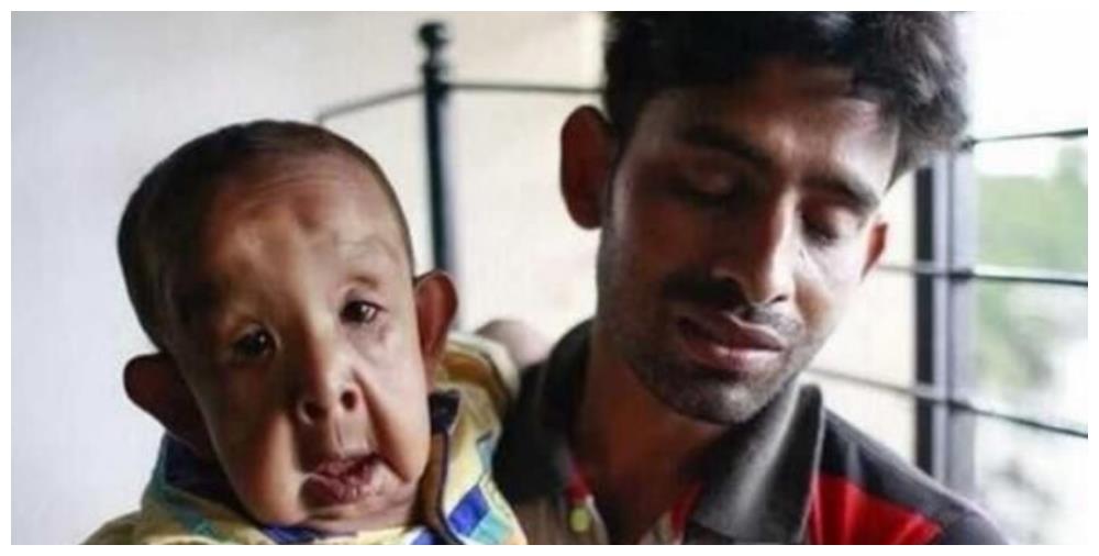 近亲结婚的后果你绝对没有想到,原来这么可怕,难怪我国会禁止!