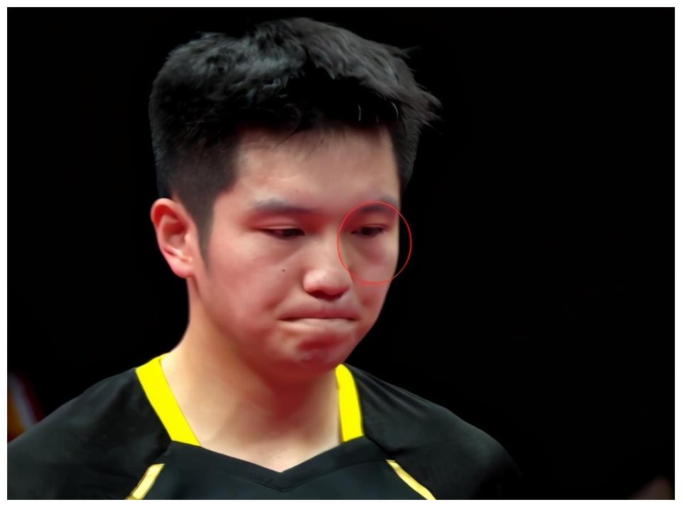 樊振东的眼睛被球击中,一度痛苦捂脸!坚持比赛淘汰巴西名将